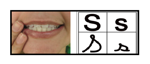 S